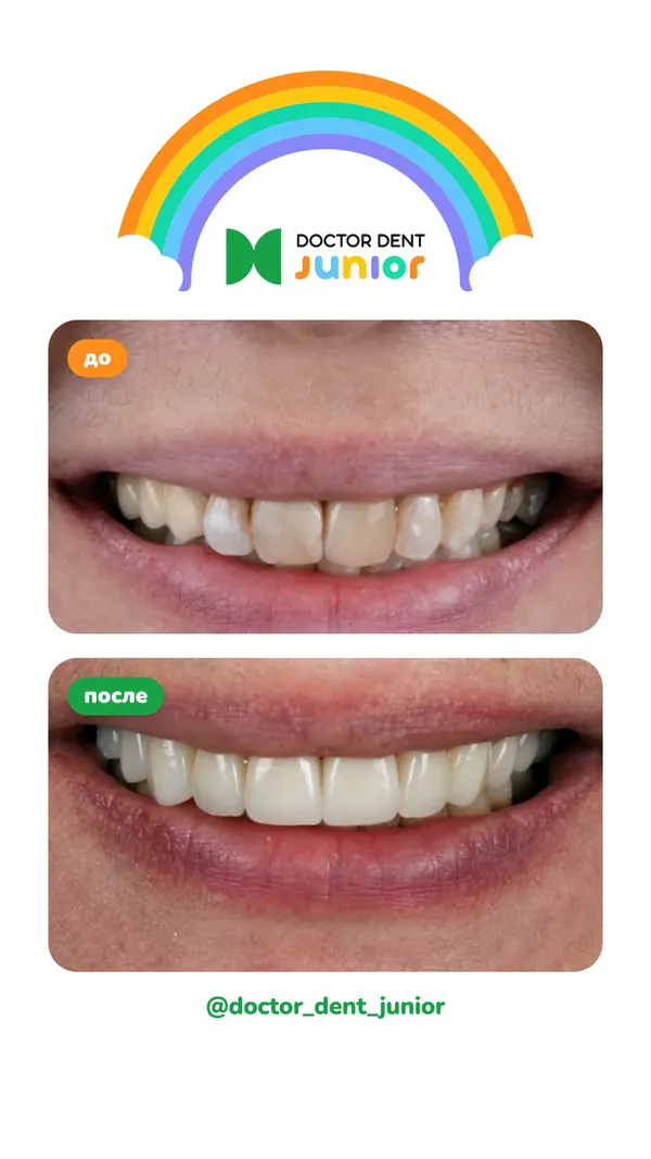 Сторис Doctor Dent Junior, дизайн Радуга