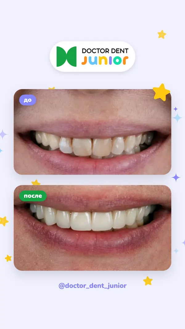 Сторис Doctor Dent Junior, дизайн Звёздочки